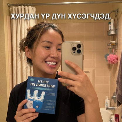 AuraGlow Teeth Whitening Kit